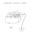 IMPLANTABLE LEAD BANDSTOP FILTER EMPLOYING AN INDUCTIVE COIL WITH     PARASITIC CAPACITANCE TO ENHANCE MRI COMPATABILITY OF ACTIVE MEDICAL     DEVICES diagram and image