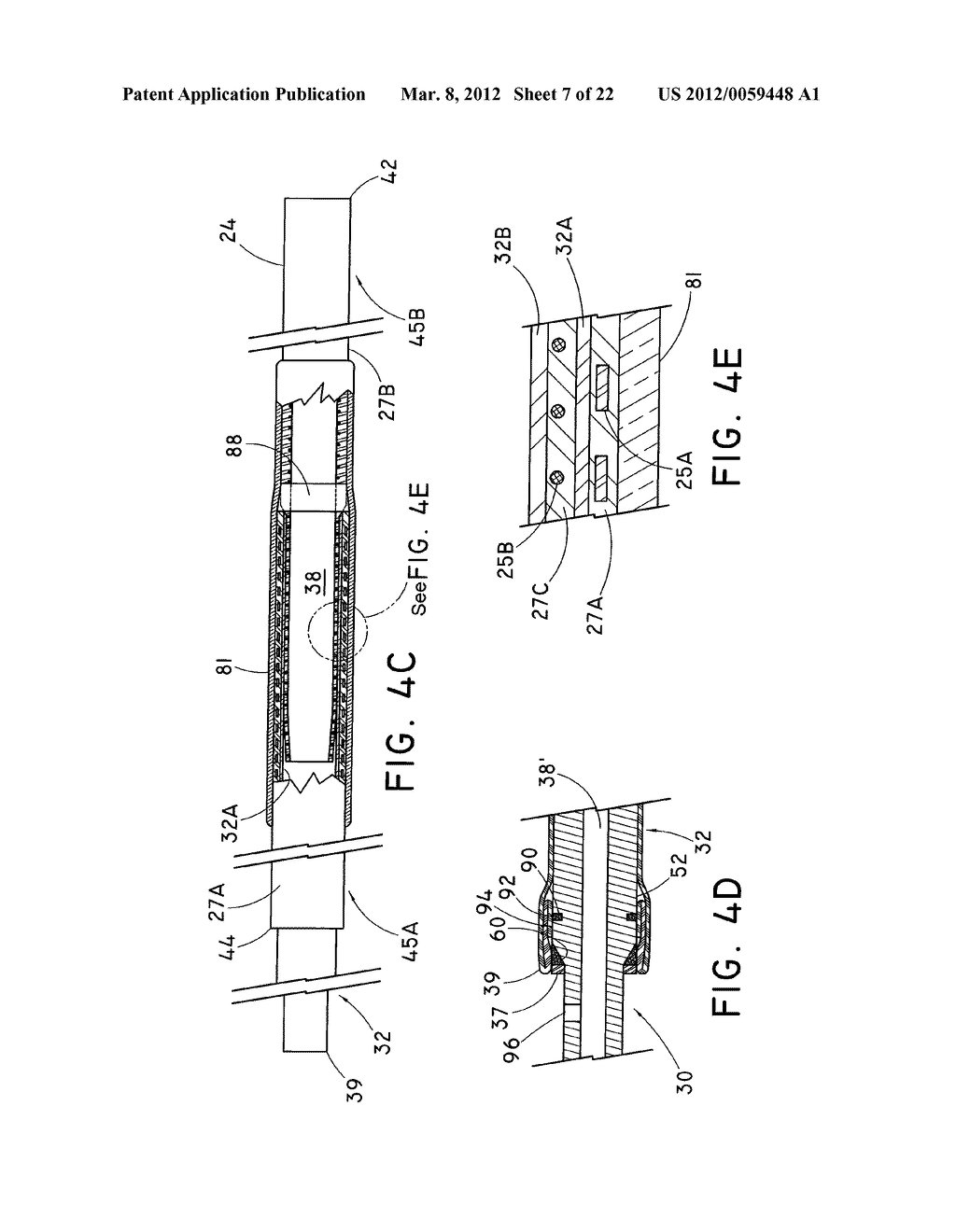 EVERTING DEPLOYMENT SYSTEM AND HANDLE - diagram, schematic, and image 08