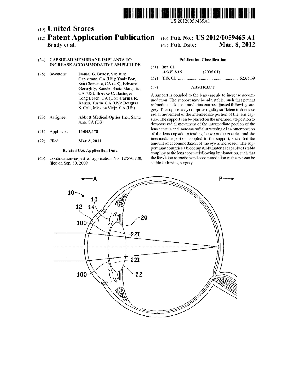 CAPSULAR MEMBRANE IMPLANTS TO INCREASE ACCOMMODATIVE AMPLITUDE - diagram, schematic, and image 01