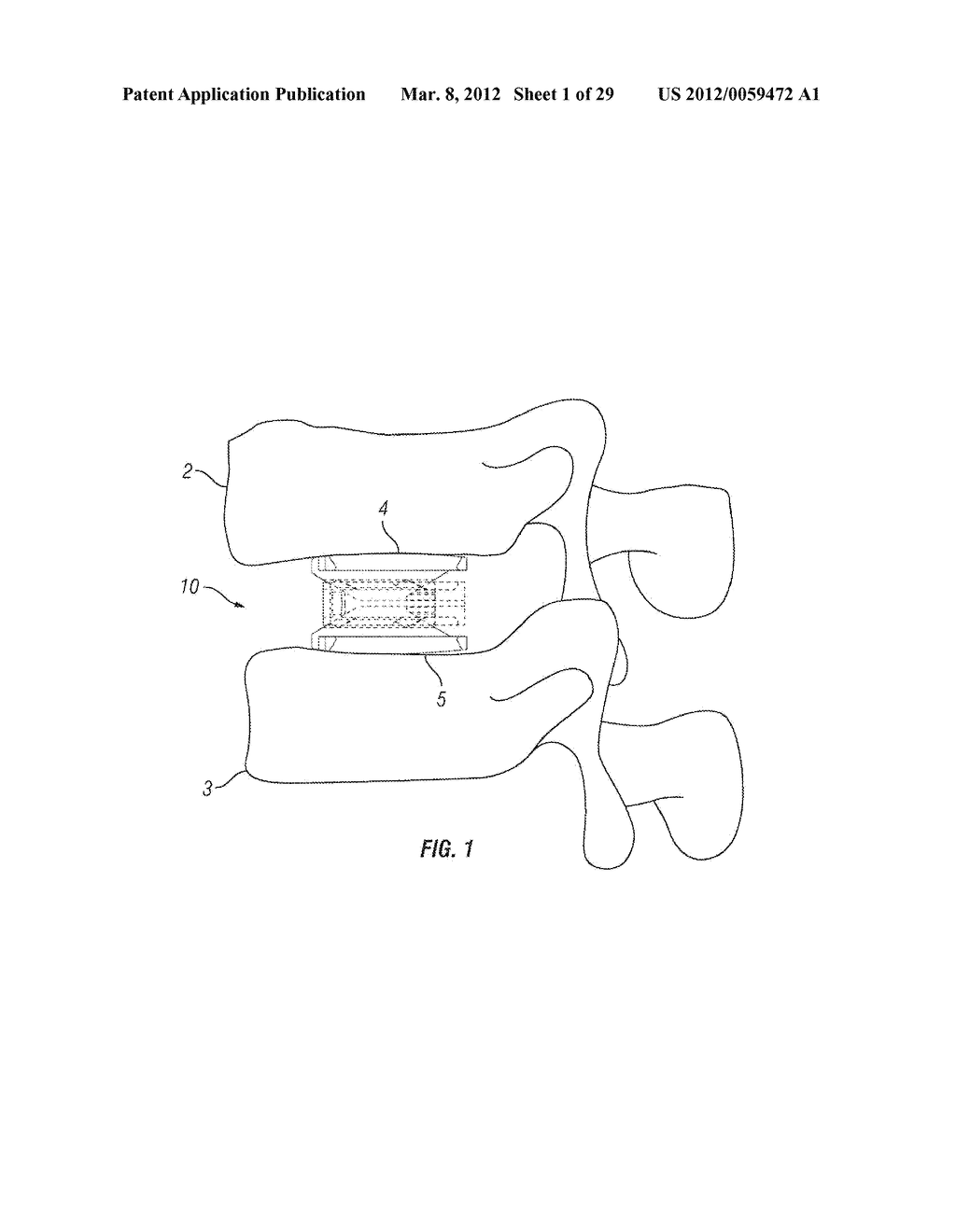 Expandable Fusion Device and Method of Installation Thereof - diagram, schematic, and image 02