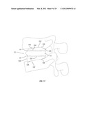 Expandable Fusion Device and Method of Installation Thereof diagram and image