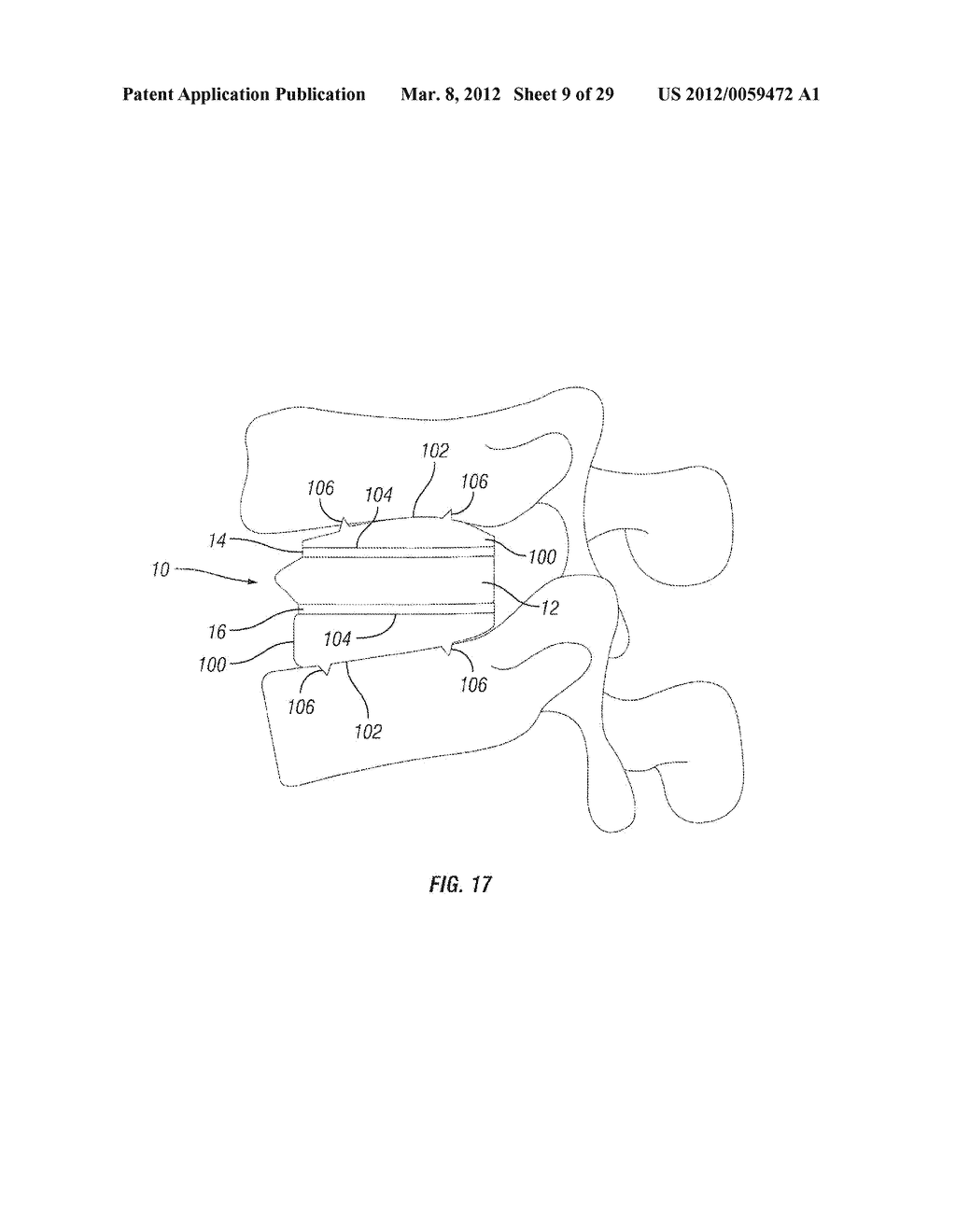 Expandable Fusion Device and Method of Installation Thereof - diagram, schematic, and image 10