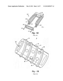 TOOLS AND METHODS FOR SPINAL FUSION diagram and image