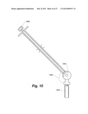 TOOLS AND METHODS FOR SPINAL FUSION diagram and image