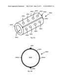 TOOLS AND METHODS FOR SPINAL FUSION diagram and image