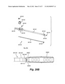 TOOLS AND METHODS FOR SPINAL FUSION diagram and image