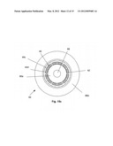 ORTHOPEDIC INTERFACE DEVICE AND METHOD diagram and image