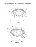 ORTHOPEDIC INTERFACE DEVICE AND METHOD diagram and image