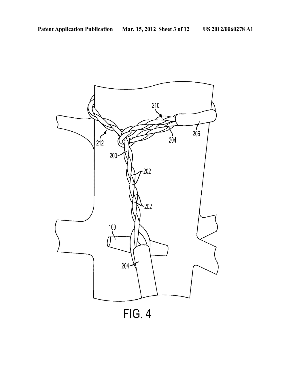 Rope and Fastener Assembly - diagram, schematic, and image 04