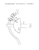 NON-CONTACT CYMBAL PICKUP USING MULTIPLE MICROPHONES diagram and image