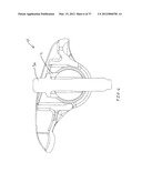 ROCKER ARM ASSEMBLY WITH AN ANTI-INVERSION FEATURE diagram and image