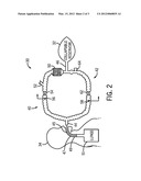 ANESTHESIA SYSTEM AND METHOD diagram and image