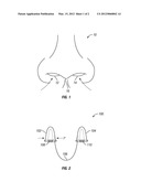 NASAL FILTRATION SYSTEM diagram and image