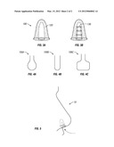 NASAL FILTRATION SYSTEM diagram and image