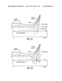 Apparatus and methods for preventing and/or healing pressure ulcers diagram and image