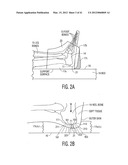 Apparatus and methods for preventing and/or healing pressure ulcers diagram and image