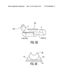 Apparatus and methods for preventing and/or healing pressure ulcers diagram and image