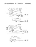 Apparatus and methods for preventing and/or healing pressure ulcers diagram and image