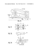 Apparatus and methods for preventing and/or healing pressure ulcers diagram and image