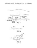 Apparatus and methods for preventing and/or healing pressure ulcers diagram and image