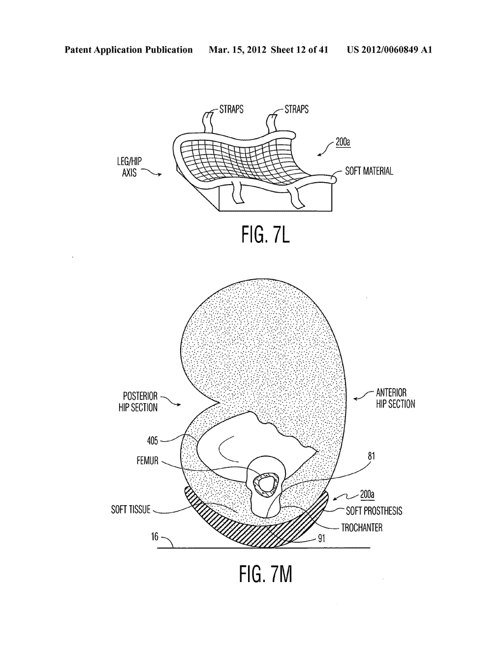 Apparatus and methods for preventing and/or healing pressure ulcers - diagram, schematic, and image 13