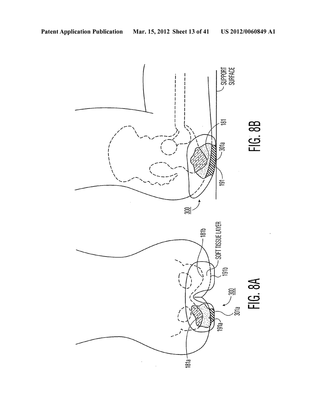 Apparatus and methods for preventing and/or healing pressure ulcers - diagram, schematic, and image 14