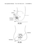 Apparatus and methods for preventing and/or healing pressure ulcers diagram and image