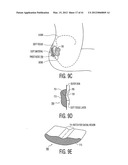 Apparatus and methods for preventing and/or healing pressure ulcers diagram and image