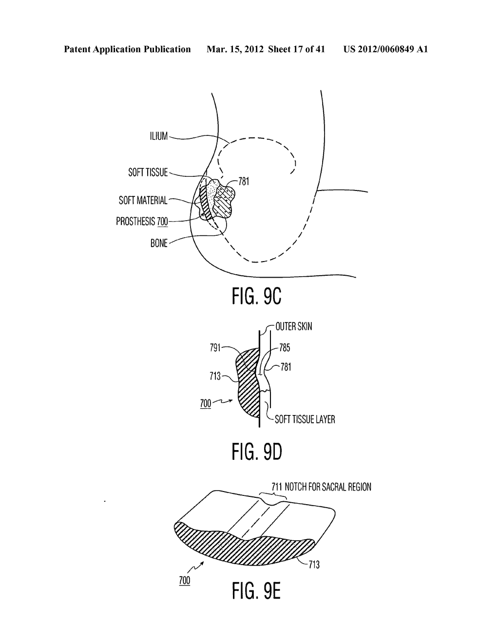 Apparatus and methods for preventing and/or healing pressure ulcers - diagram, schematic, and image 18