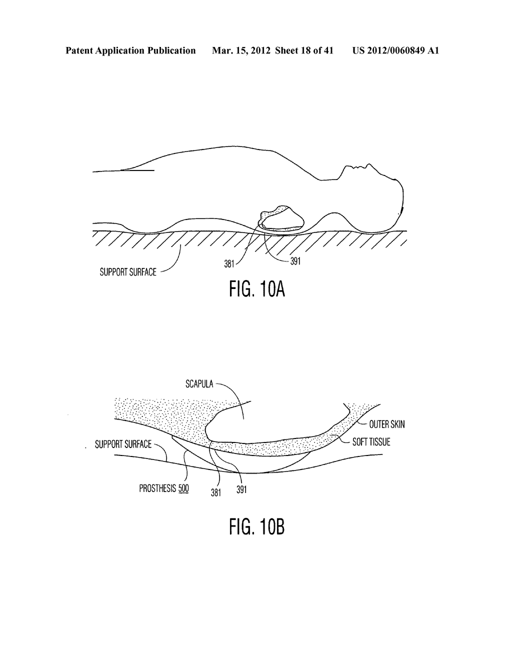 Apparatus and methods for preventing and/or healing pressure ulcers - diagram, schematic, and image 19