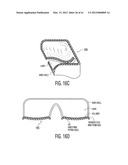 Apparatus and methods for preventing and/or healing pressure ulcers diagram and image