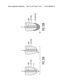 Apparatus and methods for preventing and/or healing pressure ulcers diagram and image