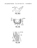 Apparatus and methods for preventing and/or healing pressure ulcers diagram and image