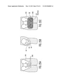 Apparatus and methods for preventing and/or healing pressure ulcers diagram and image