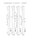 Hiccup Relief Device and Method diagram and image