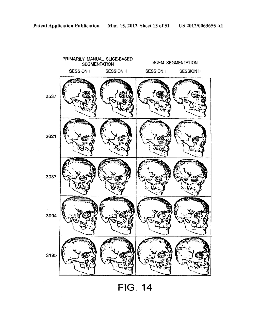 METHODS AND SYSTEMS FOR PRODUCING AN IMPLANT - diagram, schematic, and image 14