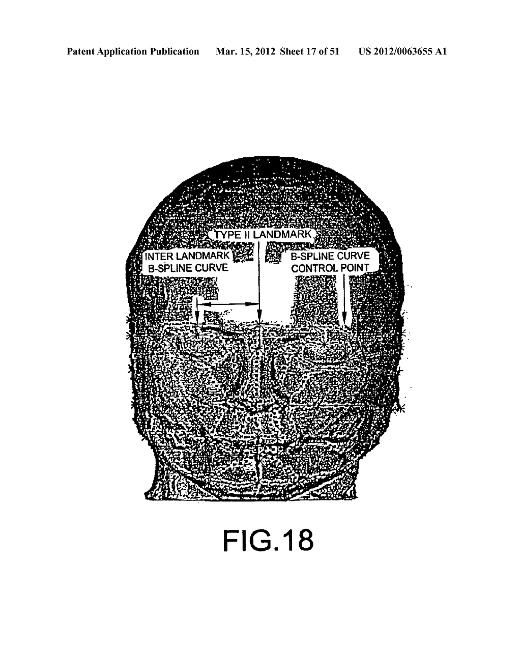METHODS AND SYSTEMS FOR PRODUCING AN IMPLANT - diagram, schematic, and image 18
