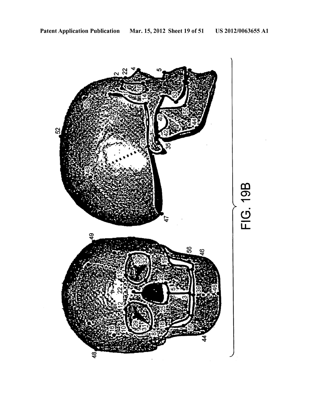 METHODS AND SYSTEMS FOR PRODUCING AN IMPLANT - diagram, schematic, and image 20