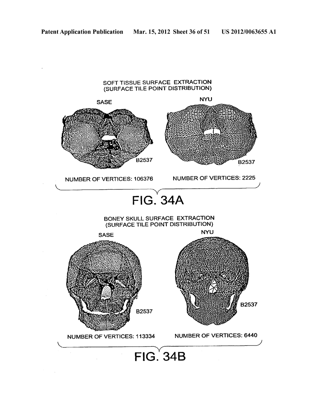 METHODS AND SYSTEMS FOR PRODUCING AN IMPLANT - diagram, schematic, and image 37