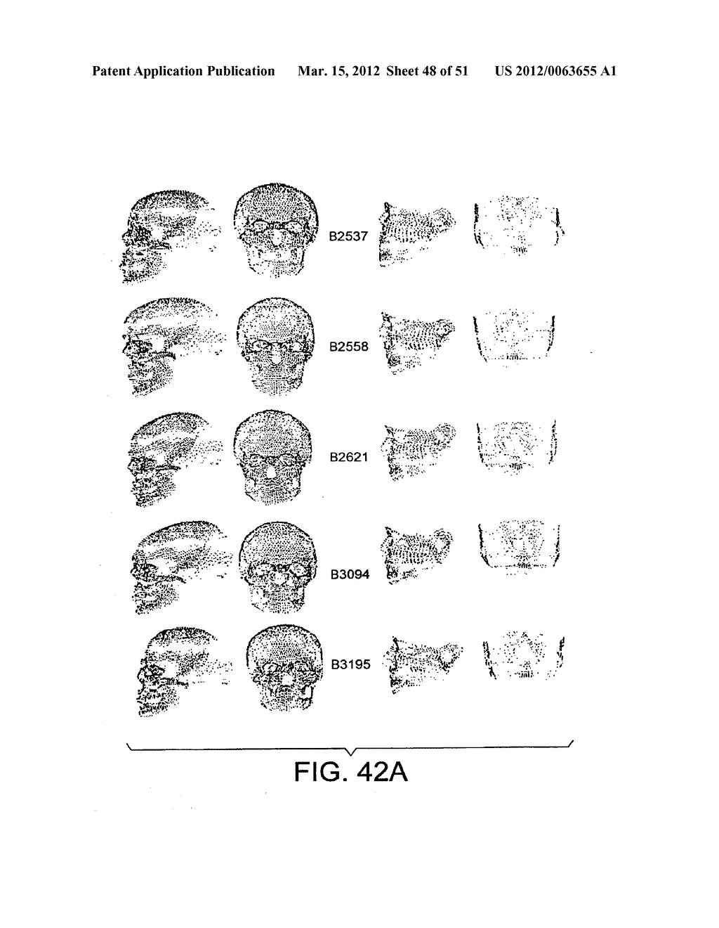 METHODS AND SYSTEMS FOR PRODUCING AN IMPLANT - diagram, schematic, and image 49