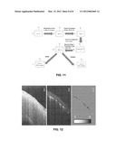 METHOD AND APPARATUS FOR QUANTITATIVE IMAGING OF BLOOD PERFUSION IN LIVING     TISSUE diagram and image