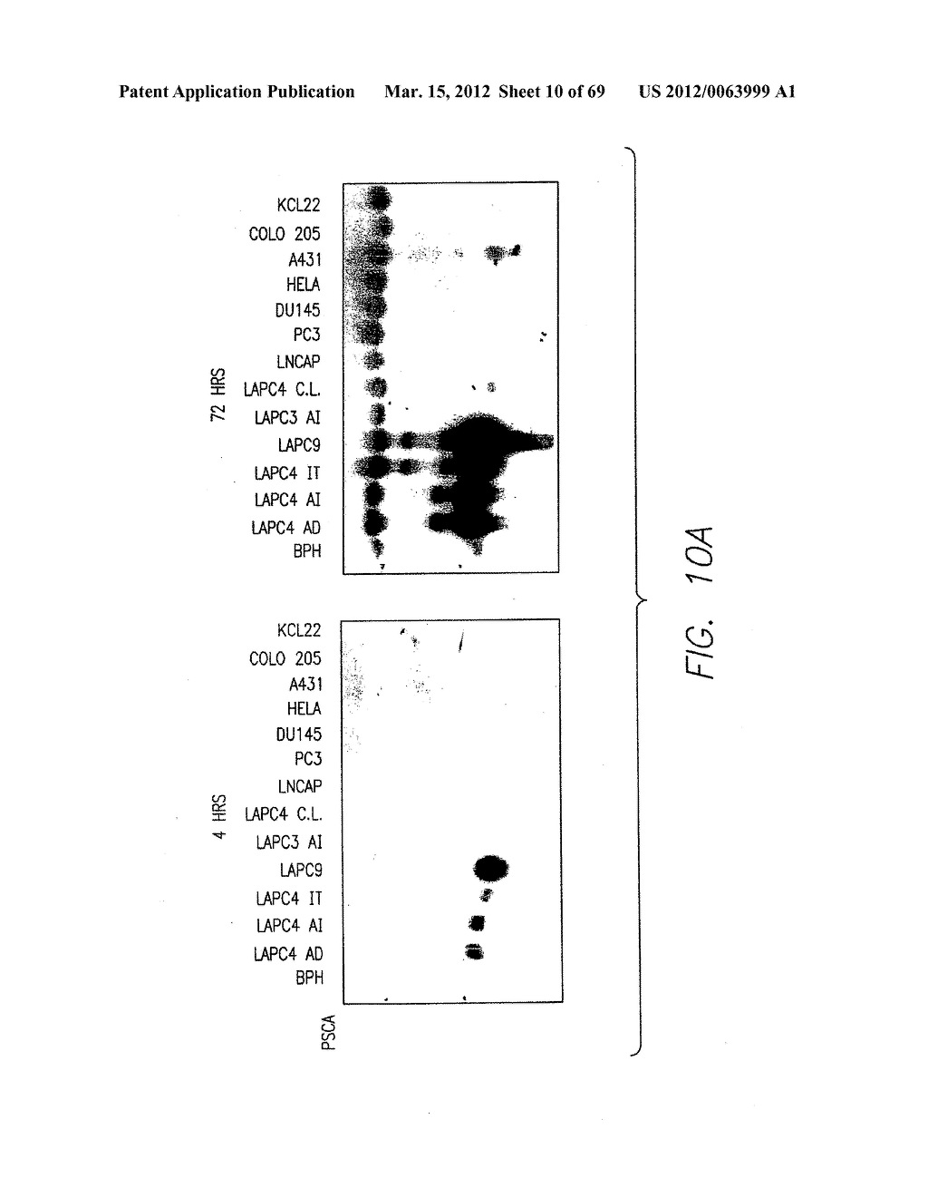 PSCA: PROSTATE STEM CELL ANTIGEN AND USES THEREOF - diagram, schematic, and image 11