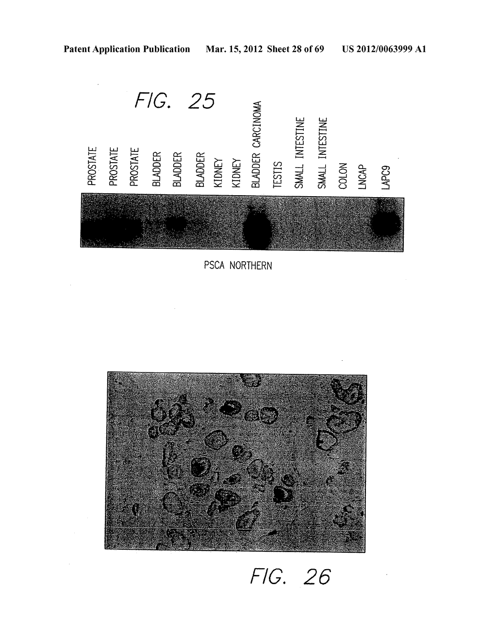 PSCA: PROSTATE STEM CELL ANTIGEN AND USES THEREOF - diagram, schematic, and image 29