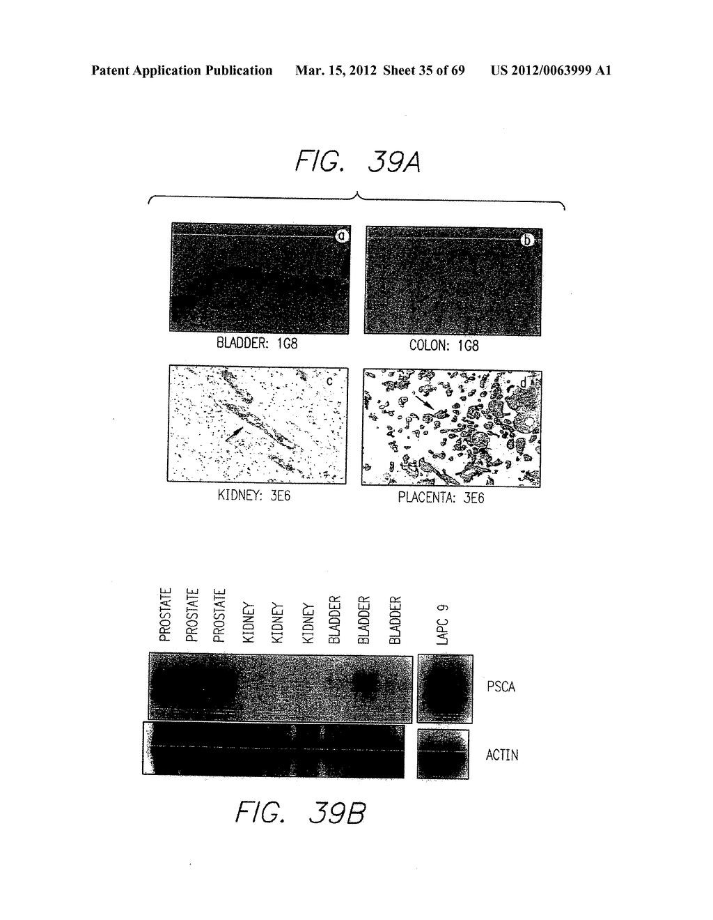 PSCA: PROSTATE STEM CELL ANTIGEN AND USES THEREOF - diagram, schematic, and image 36