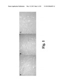 COMPOSITIONS FOR TREATING NERVOUS SYSTEM CONDITIONS diagram and image