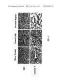 Methods For Treating Diseases and HCV Using Antibodies To     Aminophospholipids diagram and image