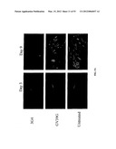 Methods For Treating Diseases and HCV Using Antibodies To     Aminophospholipids diagram and image