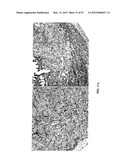 Methods For Treating Diseases and HCV Using Antibodies To     Aminophospholipids diagram and image