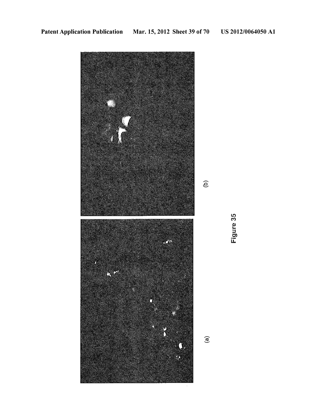 Tissue Engineering of Lung - diagram, schematic, and image 40