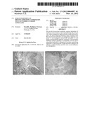 Enhanced Binding of Pro-Inflammatory Cytokines by Polysaccharide-Antibody     Conjugates diagram and image